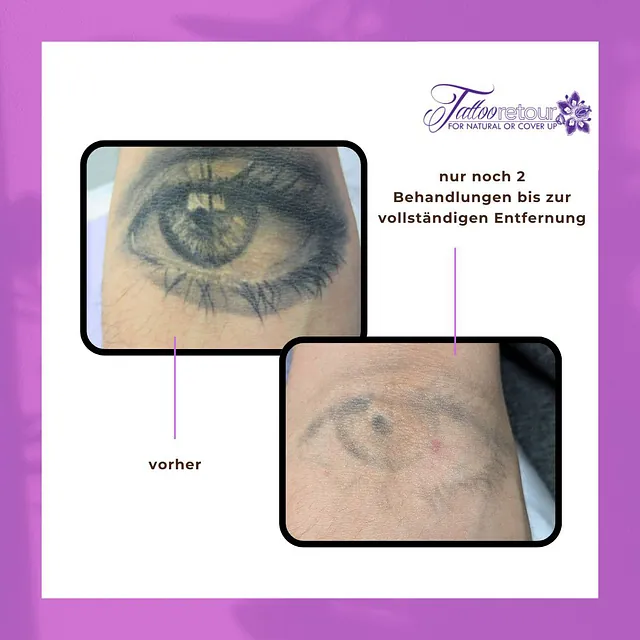 Tattooretour Oberhausen