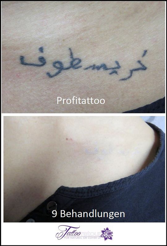Referenzen von Tattooretour - Tattooentfernung, Cover up und Permanent Make-up-Entfernung vom Profi in Oberhausen