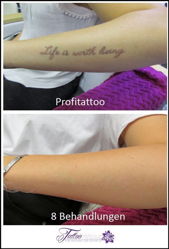 Referenzen von Tattooretour - Tattooentfernung, Cover up und Permanent Make-up-Entfernung vom Profi in Oberhausen