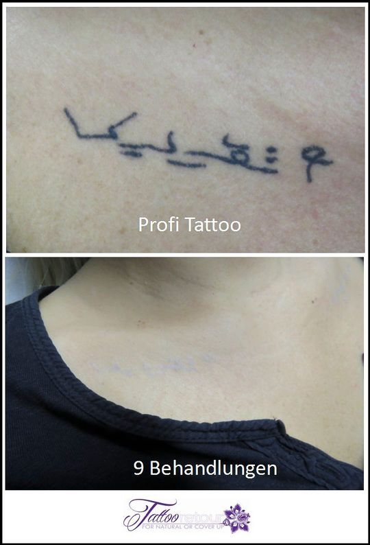 Referenzen von Tattooretour - Tattooentfernung, Cover up und Permanent Make-up-Entfernung vom Profi in Oberhausen