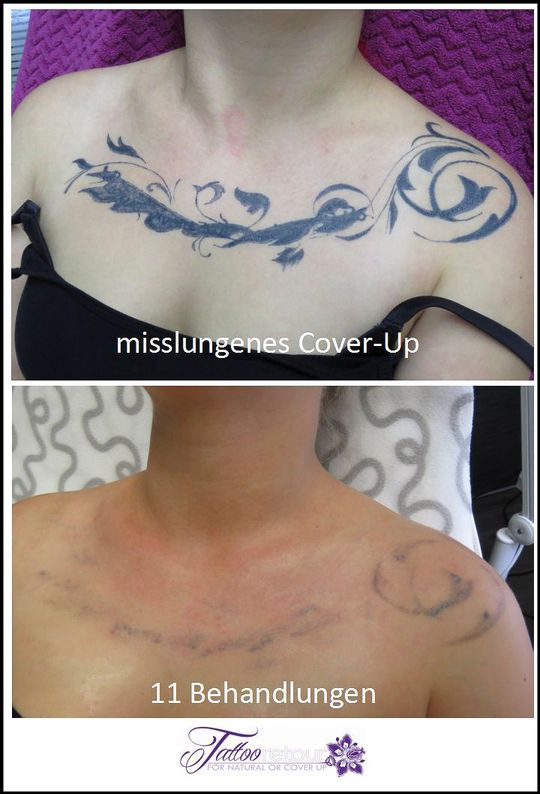 Referenzen von Tattooretour - Tattooentfernung, Cover up und Permanent Make-up-Entfernung vom Profi in Oberhausen
